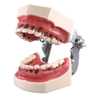 Jingle JG-Y6 — Фантомная челюсть с имитацией зубного камня