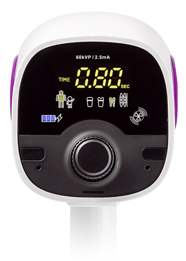 Портативный рентген WOSON JYF-10A_дисплей.jpg