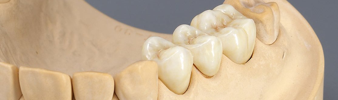 Фрезерная установка Roland DWX-52D без ПО 2.jpg