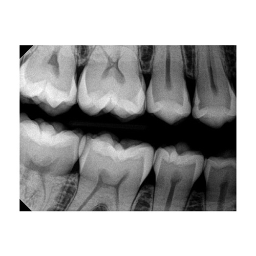 Carestream Kodak RVG 6200 - радиовизиограф