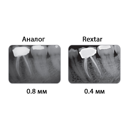 POSDION Rextar - портативный рентген