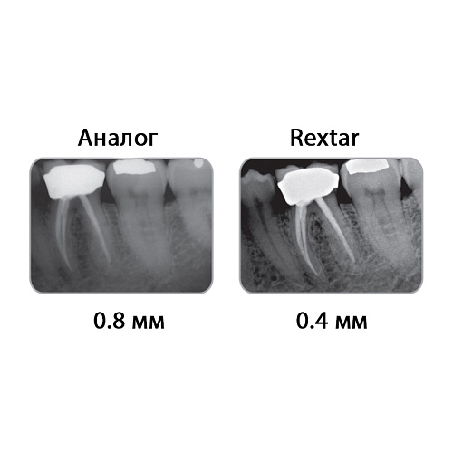 POSDION Rextar - портативный рентген