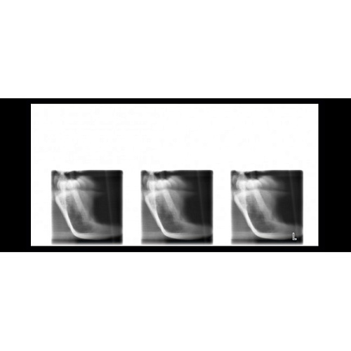 Planmeca ProOne - универсальный цифровой ортопантомограф