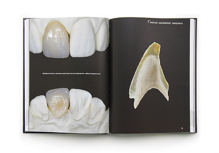 Эстетические стратегии в стоматологии. Искусство, наука и технологии. Стефано Инглезе